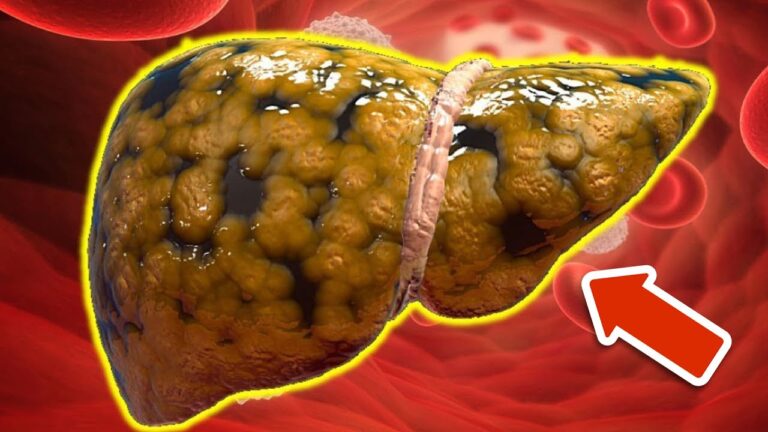 Entdecke 6 Superfoods, die deine Leber effektiv reinigen und dein Wohlbefinden steigern!