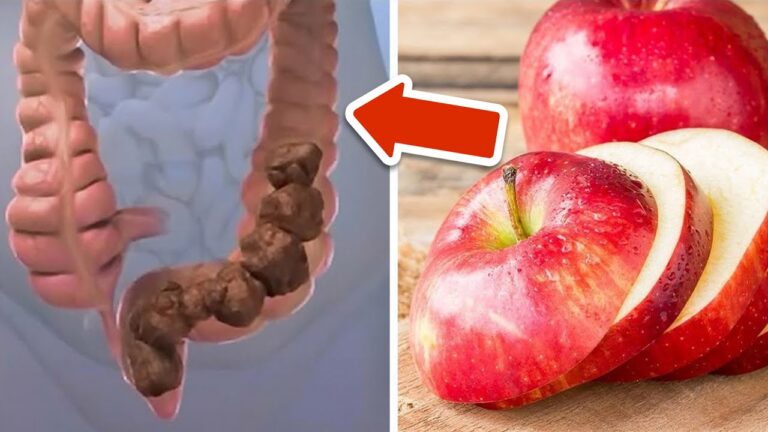 6 effektive Lebensmittel zur natürlichen Dickdarmreinigung für mehr Gesundheit