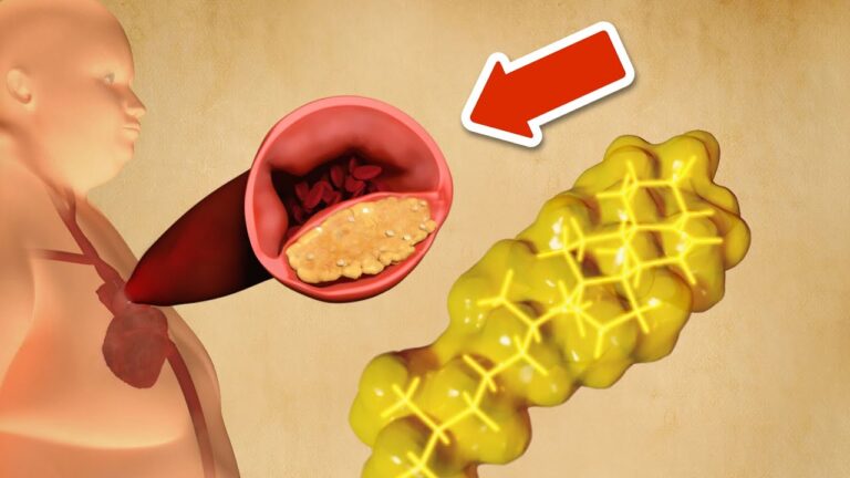 Senke deinen Cholesterinspiegel mit diesen 6 einfachen Tipps ganz ohne Medikamente!