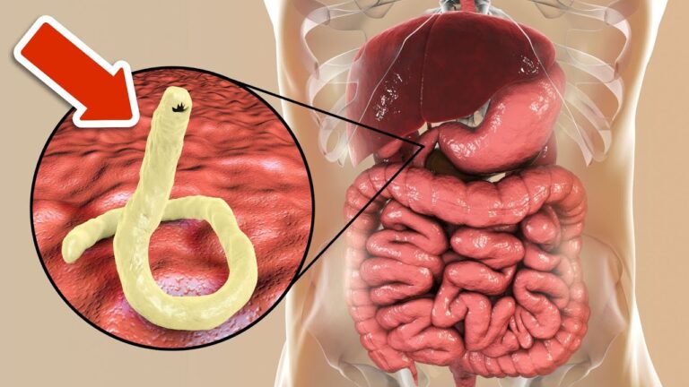 4 natürliche Heilmittel gegen Darmparasiten, die du sofort testen kannst! 💪✨