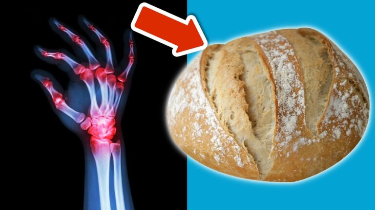 Vermeide diese 4 Lebensmittel bei Arthritis für weniger Schmerzen und mehr Wohlbefinden!